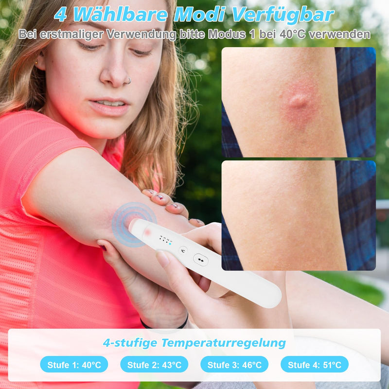 [Australia] - Mosquito Bite Heat Pen Insect Bite Healer Quick Relief from Itching and Swelling, SOARFLY Electric Insect Bite Healer, Heat Pen Against Mosquito Bites 