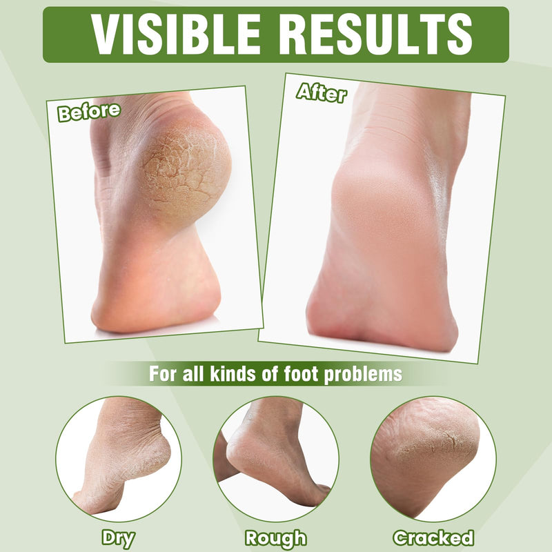 [Australia] - 18 Pairs Moisturizing Foot Masks with Shea Butter, Jojoba Oil, Vitamin E & Urea, Intensely Hydrating Foot Mask For Dry Cracked Feet, Moisturizing Socks for Cracked Heel Treatment 1 Count (Pack of 18) 