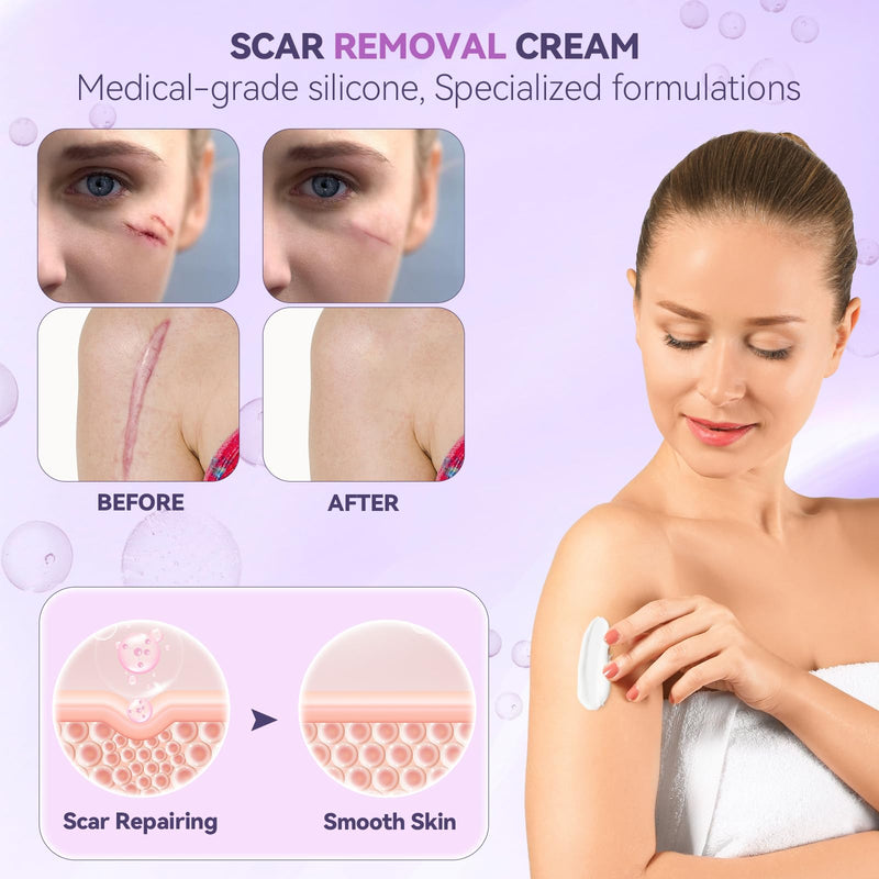 [Australia] - Advanced Scar Cream, Silicone Scar Gel for Old and New Scars, Scar Removal Cream for Surgical Scars, Stretch Marks, C-Section, Keloids, Injury, Acne, and More 1.7 oz(50ml) 