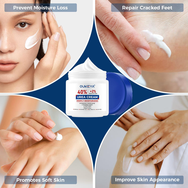 OUKEYA Urea Cream 40% with 2% Salicylic Acid, 12.35 Ounce 12.35 Ounce (40% +2% Urea Cream)