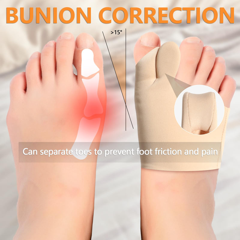 [Australia] - Chanurae Hallux valgus correction 1 pair of hallux valgus splints, toe separator hallux valgus hallux valgus socks, for pain relief, built-in removable silicone shock absorbers. 