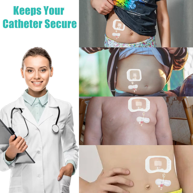 [Australia] - Catheter Stabilization Device,Feeding Tube Holder,Self Adhesive Catheter Holder Patch Dressing (10 Pack) 10 Pack 