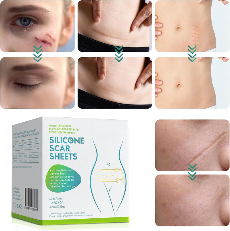 [Australia] - Medical Grade Silicone Scar Sheets, Silicone Scar Tape (1.6”x 60” Roll-1.5M), Professional Scar Removal Treatment, Reusable Silicone Scar Strip for Keloid, C-Section, Surgery, Burns, Acne Etc Brown 