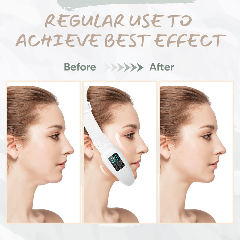 V-Face Electric Double Chin Device with 8 Modes & 15 Gear Adjustable Intensities - Intelligent V-Face Machine for Contouring Double Chin - H092