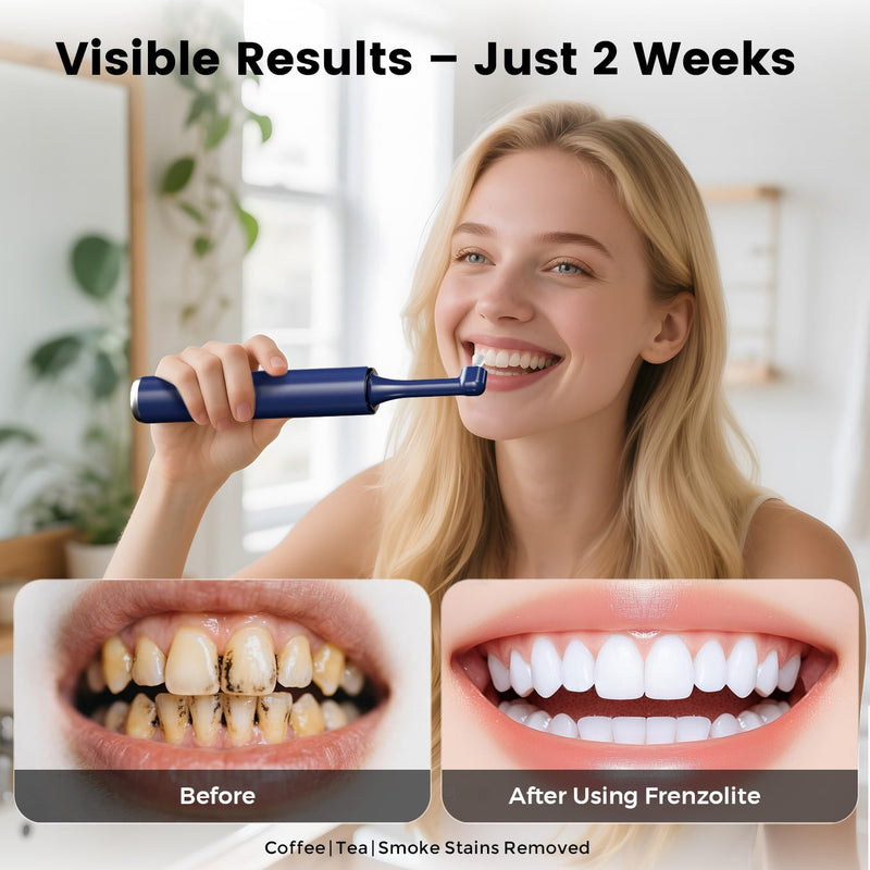 Dental Tooth Polisher for Teeth Cleaning, Teeth Polishing Kit with 5 Replaceable Heads, 4 Modes, LED Light, USB-C Rechargeable Plaque Remover for Teeth, IPX6 Waterproof Oral Care Tool for Braces