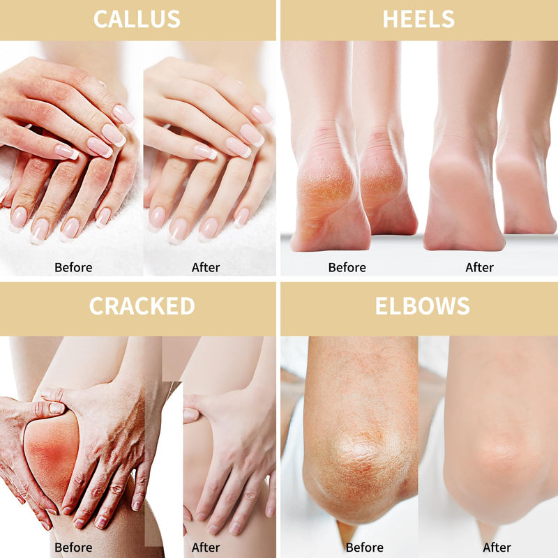 [Australia] - Grocerism Urea Cream 50 Percent for Feet 10.58 oz with Oat and 2% Salicylic Acid, Foot & Hand Cream included Hyaluronic Acid, Tea Tree and Aloe Vera for Deep Moisturizing, Callus Removing 2PS 