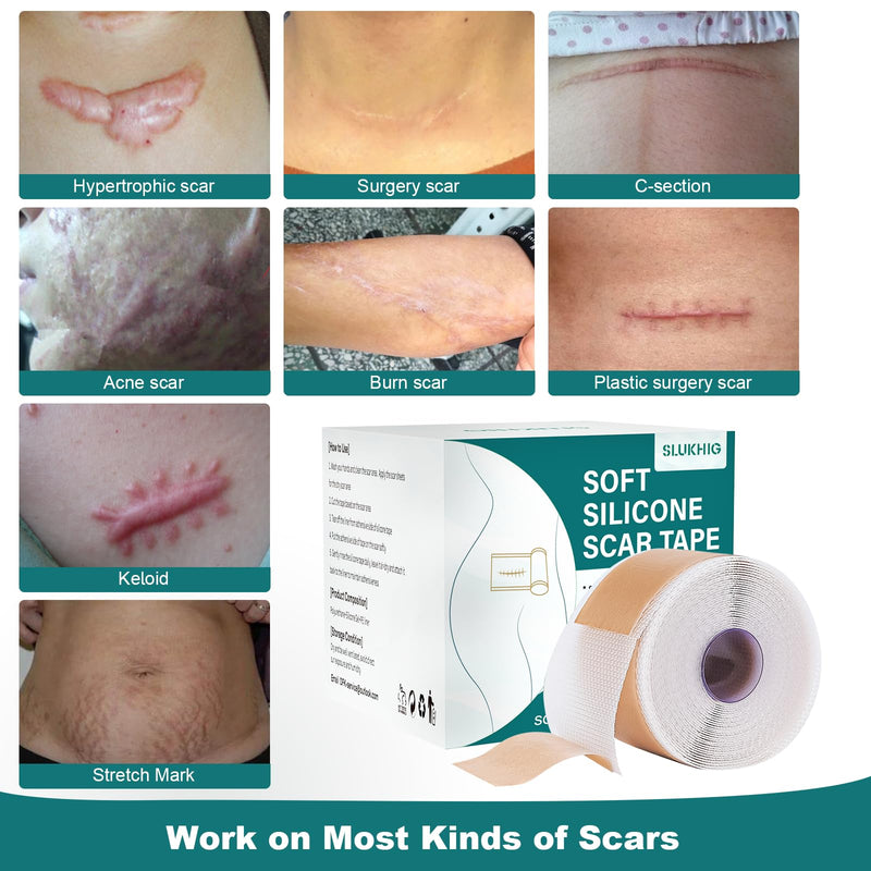 [Australia] - Silicone Scar Sheets (1.6"x 158" Roll-4M), Silicone Scar Tape for Scar Removal Treatment, Reusable Silicone Scar Strips for C-Section, Keloid, Burn, Acne, Surgical Scars 1.6"×158" 