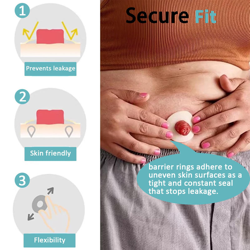 [Australia] - 20PCS Ostomy Barrier Rings, Medical Hydrocolloid Ostomy Supplies, Moldable Ostomy Ring, Leak-Free Skin Extender Rings, Stoma Protector Seal for Colostomy Bags 