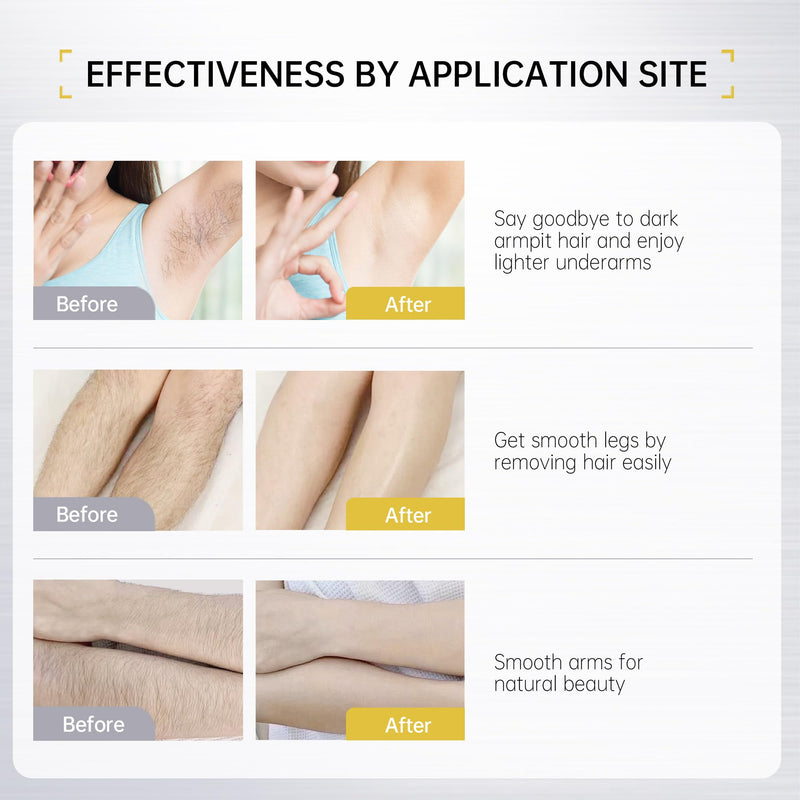 [Australia] - VGO Painless Hair Removal Lotion for Women & Men - For Unwanted Hair, All Skin Types, White, 4.02 oz 