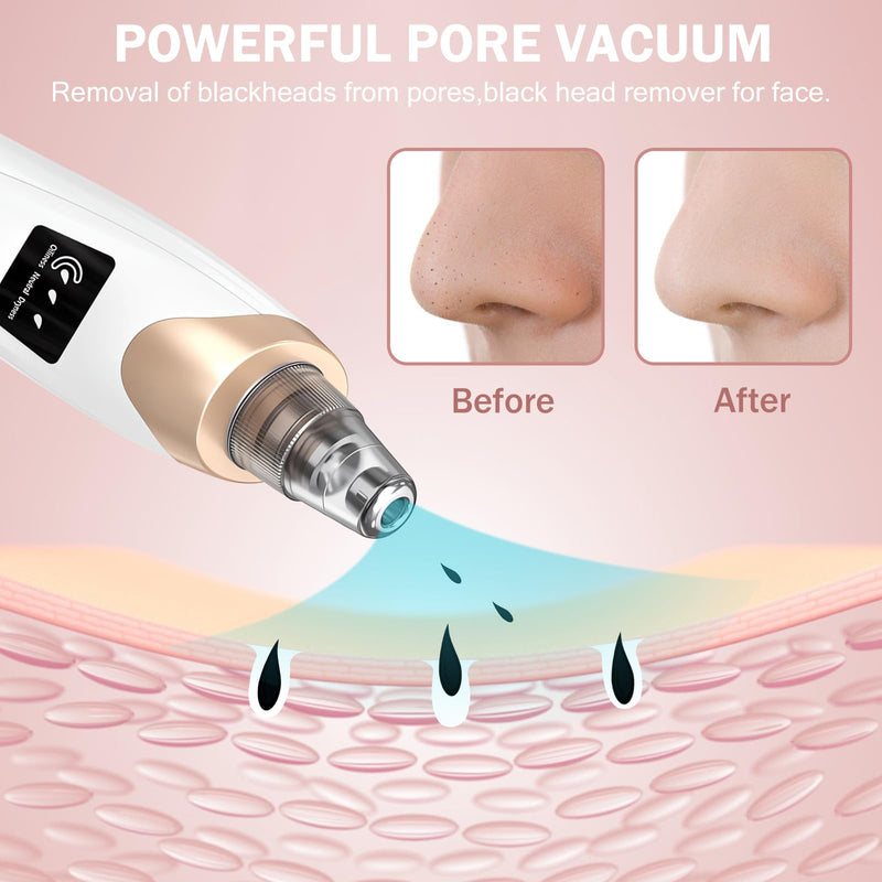 Blackhead Remover Pore Vacuum Kit -Blackhead Extractor Tool with 3 Adjustable Suction Levels, 5 Probes, USB Rechargeable, Suitable for Women and Men(White) White