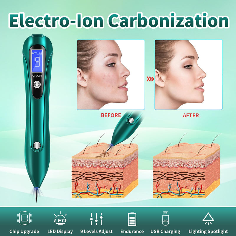 [Australia] - CHRERNA Plasma Pen device for hand and body (warts, birthmarks, nevus, birthmarks, pigment spots, age spots) green 