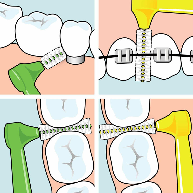 [Australia] - TEPE Angle interdental brushes green (ISO size 5: 0.8 mm) / Controlled cleaning of the spaces between teeth even in hard-to-reach places / 1 x 6 Angle interdental brushes 