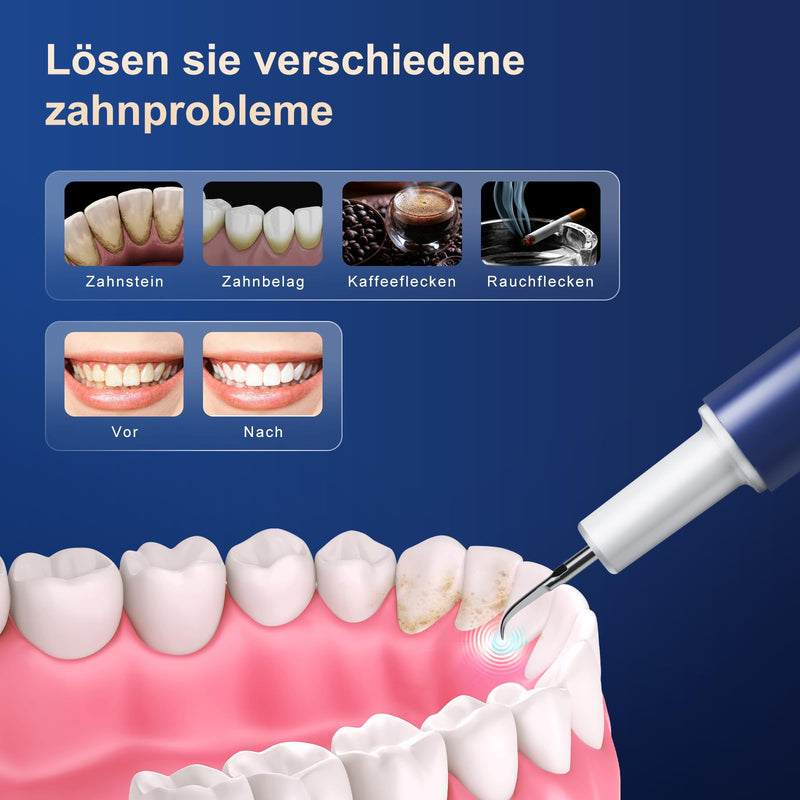 [Australia] - Tartar Remover Teeth Cleaning Set Electric Teeth Cleaning Set Ultrasonic Toothbrush for Tooth Care at Home with 4 Adjustable Modes and 4 Interchangeable Cleaning Heads 1 Piece (Pack of 1) 