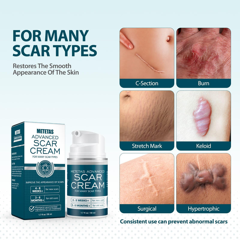 Advanced Scar Cream 1.7 Oz, Scar Cream Gel For Surgical, C-Section, Stretch Marks, Keloids, Burns Reducing Treatment, Silicone Scar Gel Effective Remove Old & New Scars -50ml