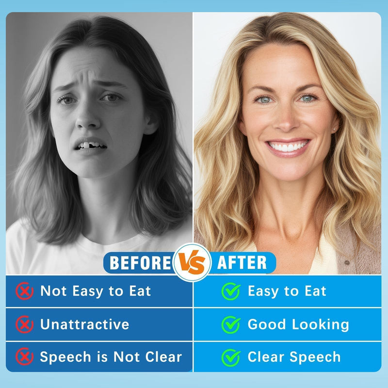 [Australia] - Moldable False Teeth - Silicone Dentures - Men and Veneers Teeth for Women - Upper and Lower Matching Set - Fix Your Smile at Within Minutes - Blue - 1PCS 