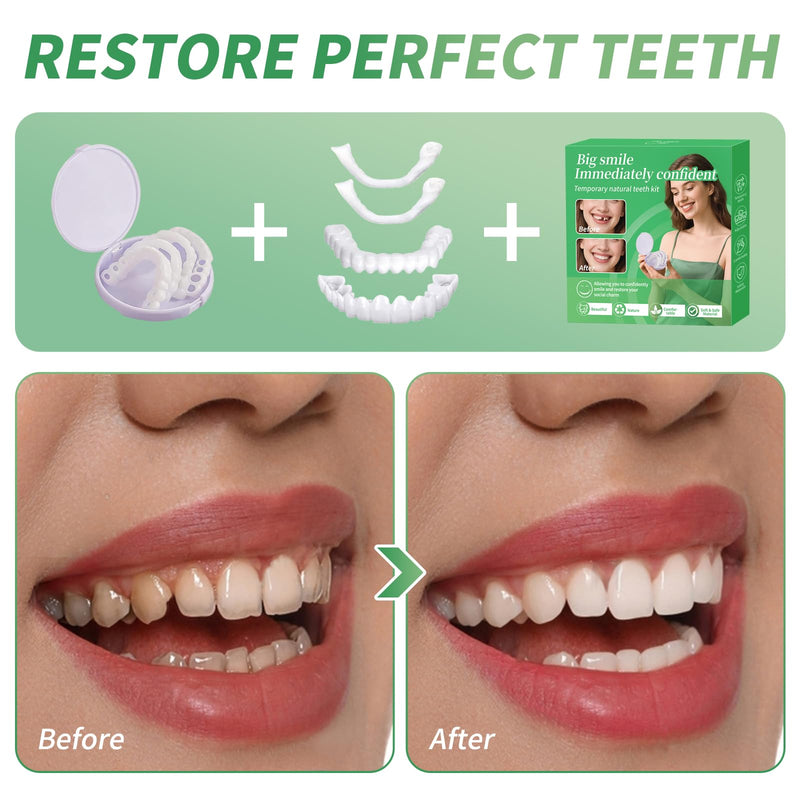 [Australia] - Temporary Veneers Kit for Women and Men, Tooth Replacement Kit, Nature and Comfortable (1 Count (Pack of 1), Natural)-FF01 