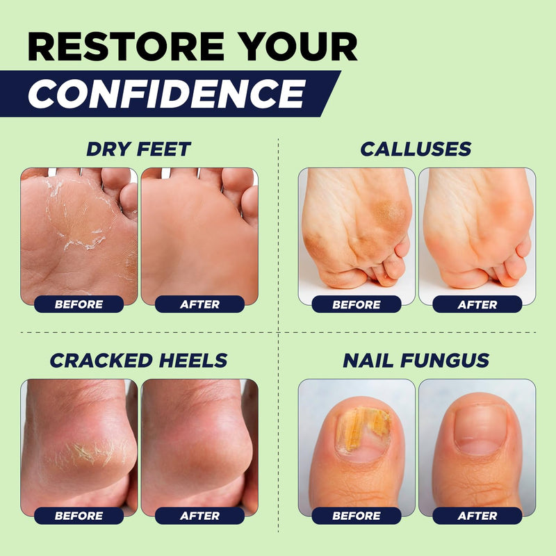 Tea Tree Oil Foot Soak with Epsom Salt - For Toenail Repair, Athletes Foot, Softens Calluses, Soothes Sore & Tired Feet, Nail Discoloration, odor Scent, Spa Pedicure Care - Made in USA 16 oz Tea Tree 16 Ounce (Pack of 1)