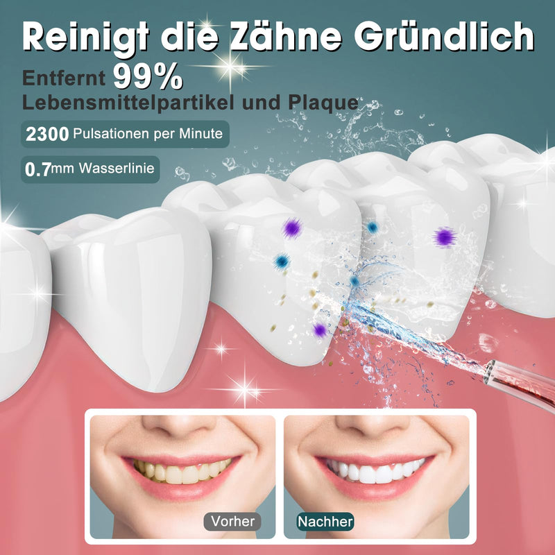 [Australia] - Travel Oral Irrigator Wireless, Mini Portable Water Flosser, Nimmu Oral Irrigator Small Travel Electric Tooth Cleaner Unlimited Gear Adjustment & 3 Nozzles, Electric Tooth Cleaning, 35 Day Running Time Black 