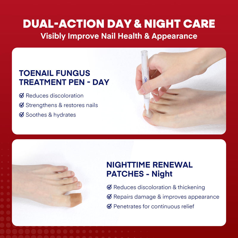 Treatonic Toenail Fungus Treatment Kit: Antifungal Nail Fungus Treatment Extra Strength with 25% Undecylenic Acid (3 Pens) & 32 Night Fungal Nail Patches - Repairs Damaged & Restores Discolored Nails 1-Pack(3 Pens + 32 Patches-Arc)