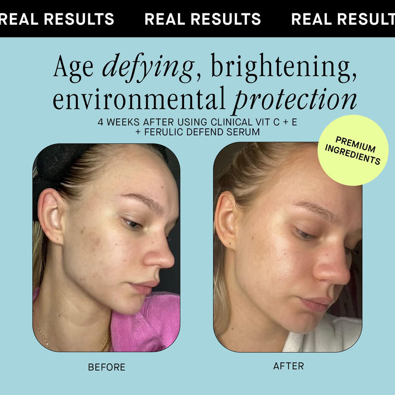 Brandefy Vitamin C Face Serum 15% L. Ascorbic Acid, Ferulic Acid .5% + Vitamin E for Self Care and Beauty, Face Dark Spot Corrector and Anti Aging 1oz, Made In The USA