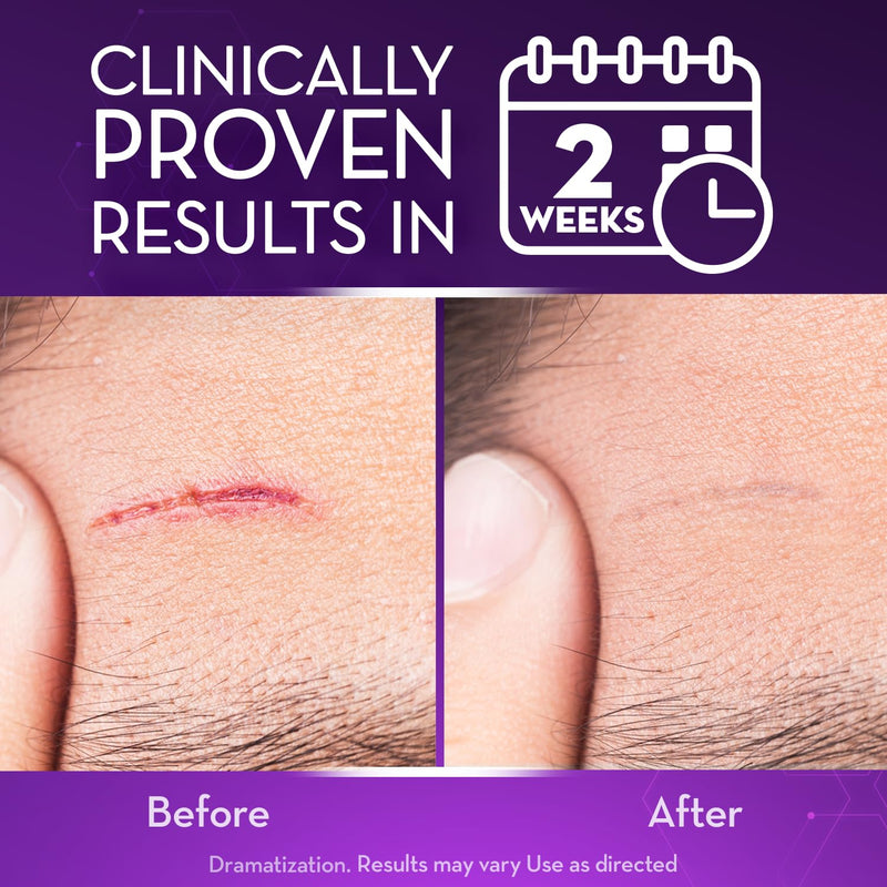 [Australia] - Cicatricure Advanced Scar Gel for Face & Body - Proven Results in 2 Weeks, Scar Treatment for Surgical Scars, Stretch Marks, Scars of Burns and Injuries, Acne Scar Treatment, 1 oz (28 g) Face & Body Scar Gel, 1oz 