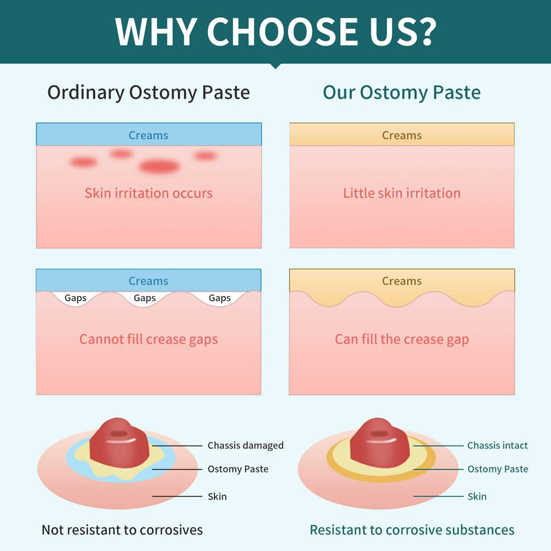 [Australia] - ostomy Filler Paste 2 oz. Tube (1 Tube) 