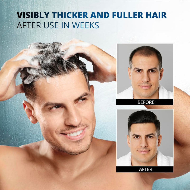Root Activator Shampoo for Men: Hair Growth Shampoo for Hair Loss and Thinning Hair - Hair Loss Regrowth Shampoo for Men Women (Refreshing Scent) 10.1 Fl Oz (Pack of 1) Root Activator Shampoo