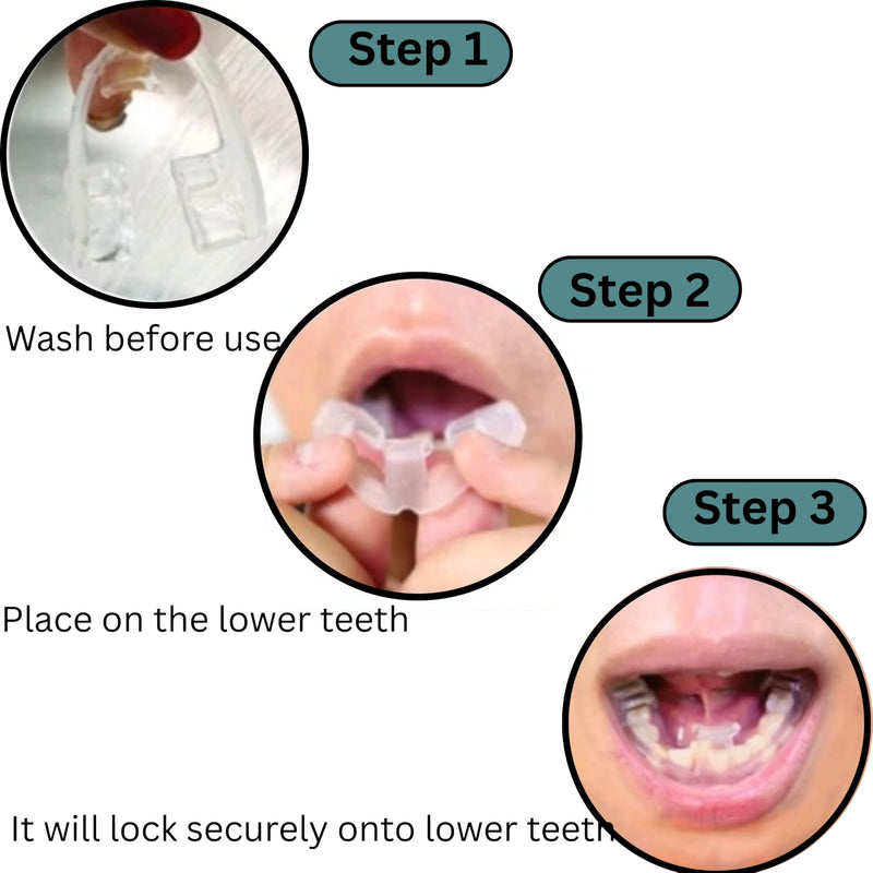 [Australia] - Mouth Piece for Teeth Grinding, Night Guards for Teeth Grinding, Mouth Guards Comfort Fit for Nighttime Protection for Teeth 