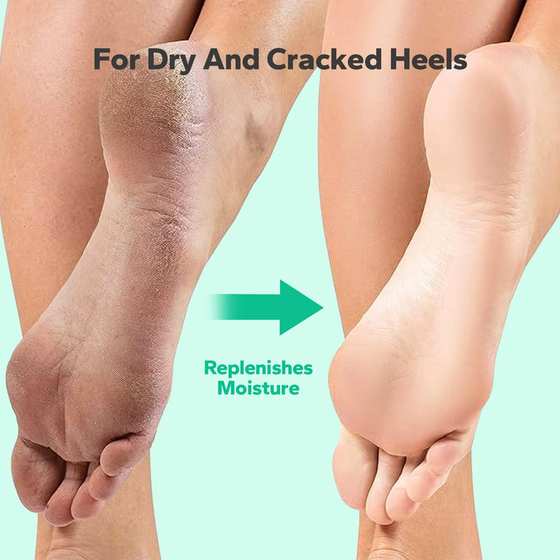 [Australia] - Callus Remover Gel for Feet (8.45 fl.oz), Powerful Formulation Foot Callus Remover, Extra Strength Callus Remover, Callus Remover for Feet Gel, Calloused Feet Remover Gel for Home Use 