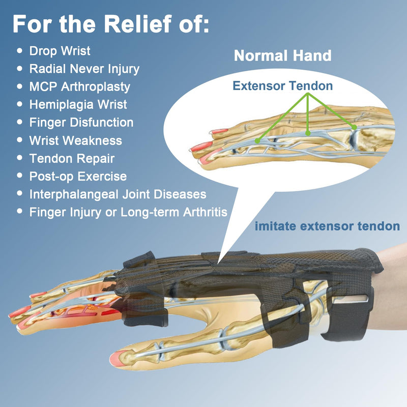 Radial Nerve Palsy Splint, Adjustable Finger Extension Brace, Lift Elastic Splint for Drop Wrist, Radial Nerve Injury, Mcp Arthroplasty, Crutch Palsy Treatment, Fit Left & Right Hand (Plastic) Plastic