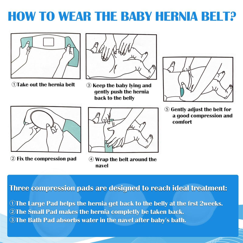 S Baby Umbilical Hernia Belt for Hernia Support and Recovery, Infant Belly Button Band Navel Truss Wrap - Soft, Skin-friendly