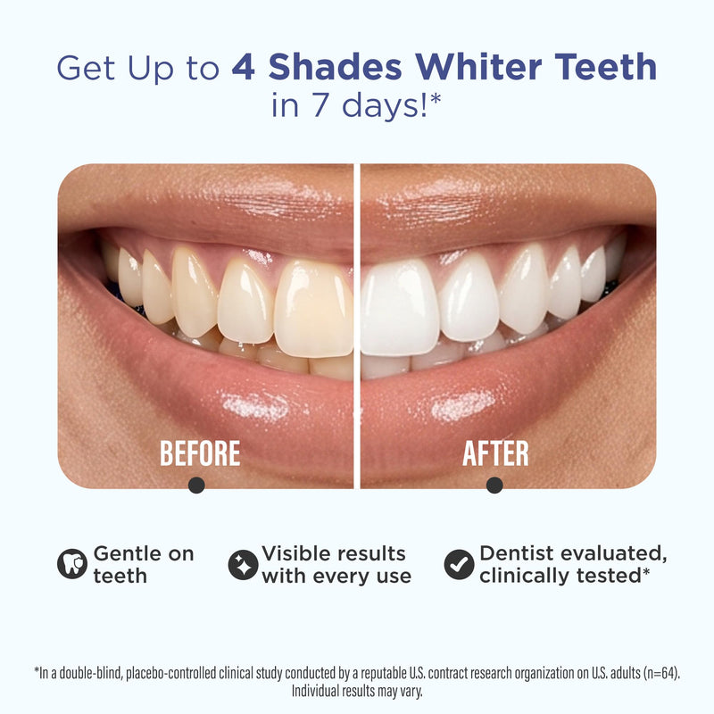 GuruNanda Teeth Whitening Strips Kit - 30-Day Treatment with Non-Slip, Dry Strip Technology - Whitening Designed with Care for a Brighter Smile 60 Count (Pack of 1)