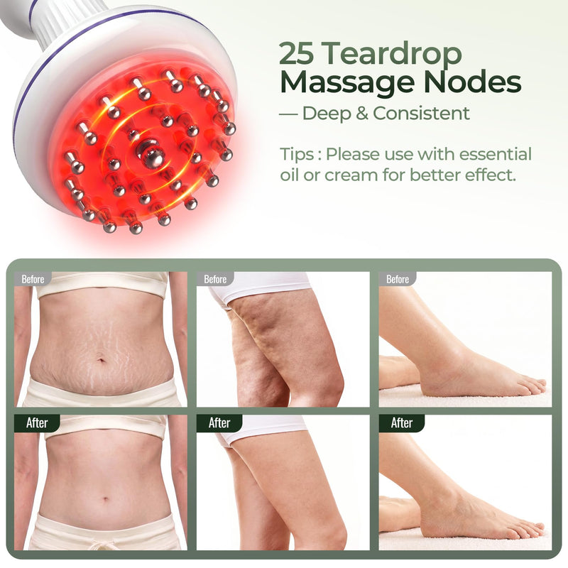 Lymphatic Drainage Massager & Anti Cellulite Tool, Cordless | Red Light, Vibration & Heat, Reduce Stretch Marks, Body Sculpting Machine for Legs, Arms & Stomach, 30 Levels, 3000mAh