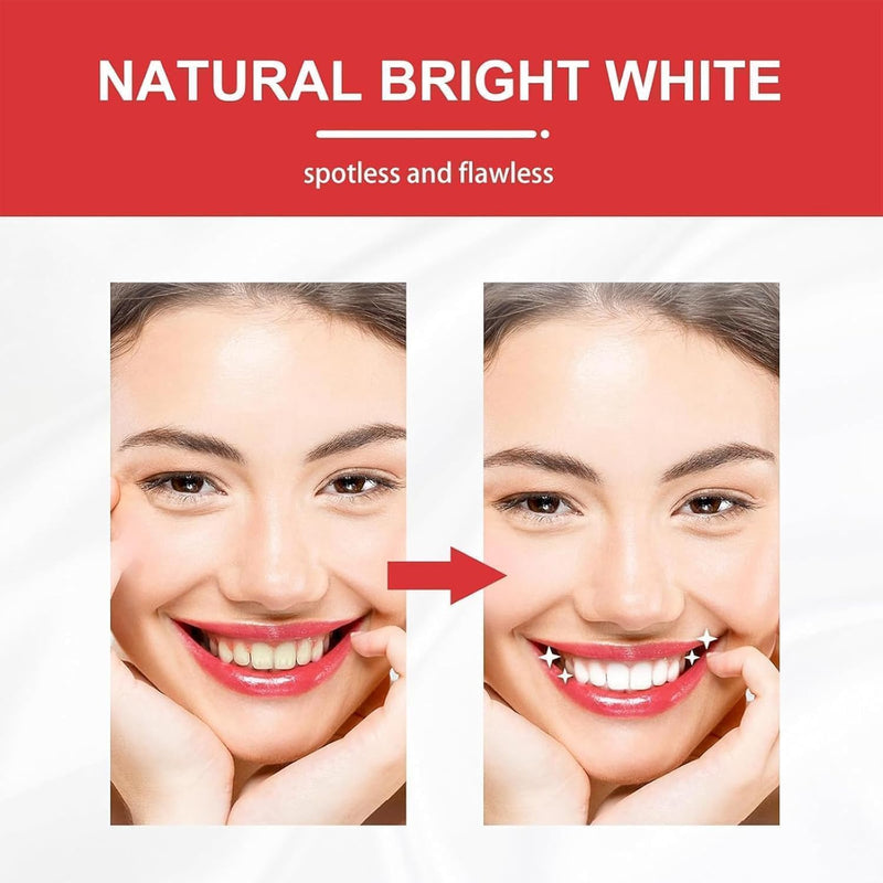 [Australia] - 2 Pcs SP10 Probiotic Toothpaste - Ultra Whitening, Brightening, Fresh Breath & Deep Cleaning 