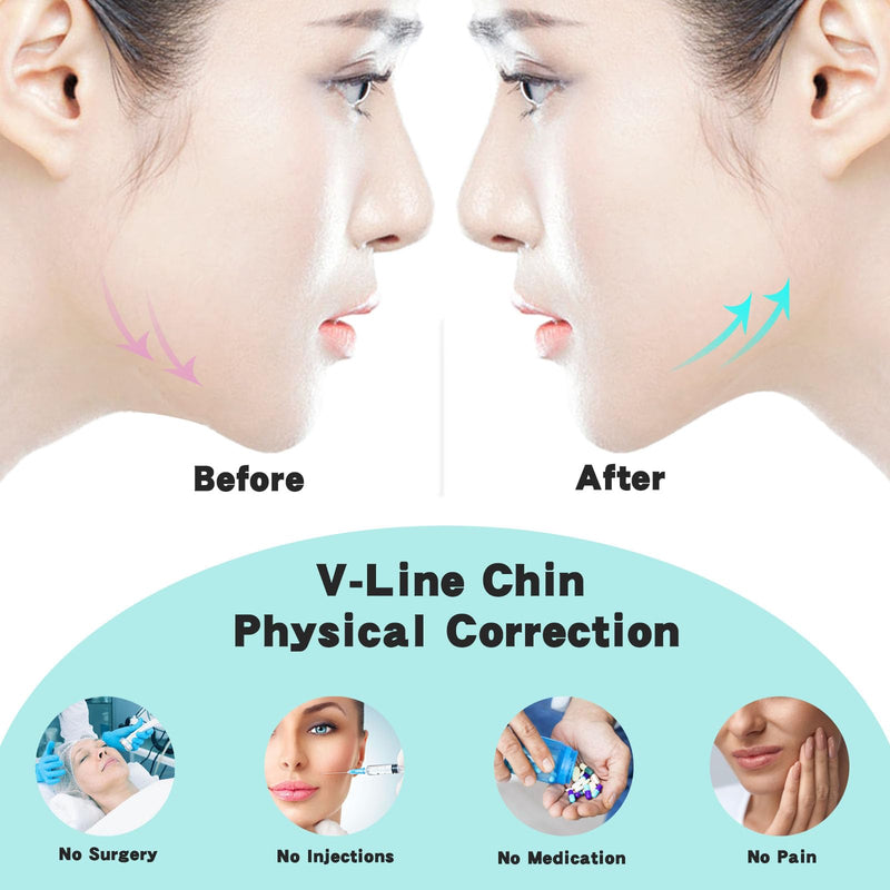 WIDVIH Silicone Chin Strap，V Line Mask Lifting Strap ，V Shaped Chin Mask for Women & Men (2PC) 2PC