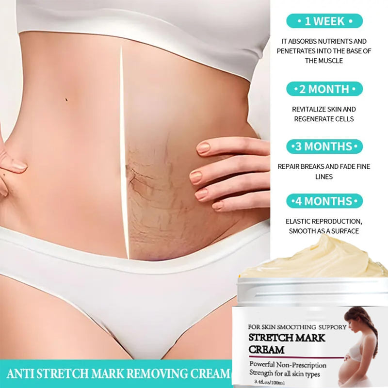 Stretch Mark Prevention Cream for Pregnancy, Stretch Mark Cream Remover, Stretch Mark Lotion for Pregnancy, Tummy Butter for Stretch Marks Pregnancy, Shea Butter Stretch Mark Removal Cream