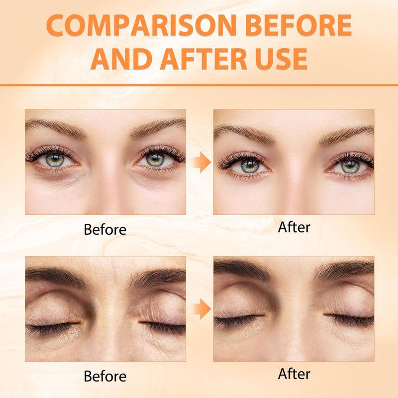 Tbexem Revive Glow Vitamin C Eye Balm, Hydrating Eye Cream,Improve Dark Circles,Brightens Skin Tone,Reduces Puffiness(2PCS)