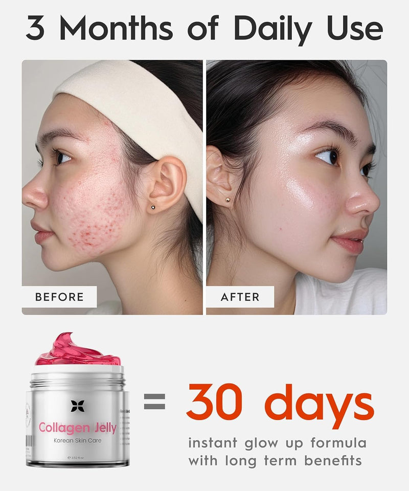 REVO Collagen Jelly – Korean Anti-Aging Plumping Formula with Hydrolyzed Collagen, Niacinamide, Hyaluronic Acid & Vitamin C – Skincare for Glass Glow Skin, Wrinkle Repair & Even Tone (1.76 Fl Oz) 1.76 Fl Oz