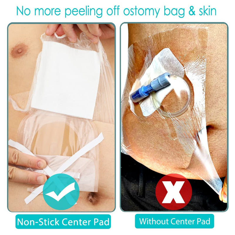 [Australia] - 25 Pcs Waterproof Stoma Shower Cover 9"x9", Ostomy Bag Protector Shield Film Bandage Adhesive Dressing for Colostomy Pouch Supply Bath Guard Accessory 9x9 Inch (Pack of 25) 