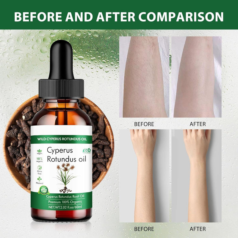 [Australia] - 2 pieces Cyperus Rotundus oil, pure Cyperus oil, natural Cyperus rotundus oil for hair removal, Cyperus rotundus oil hair removal, reduction of body hair growth (60 ml x 2). 