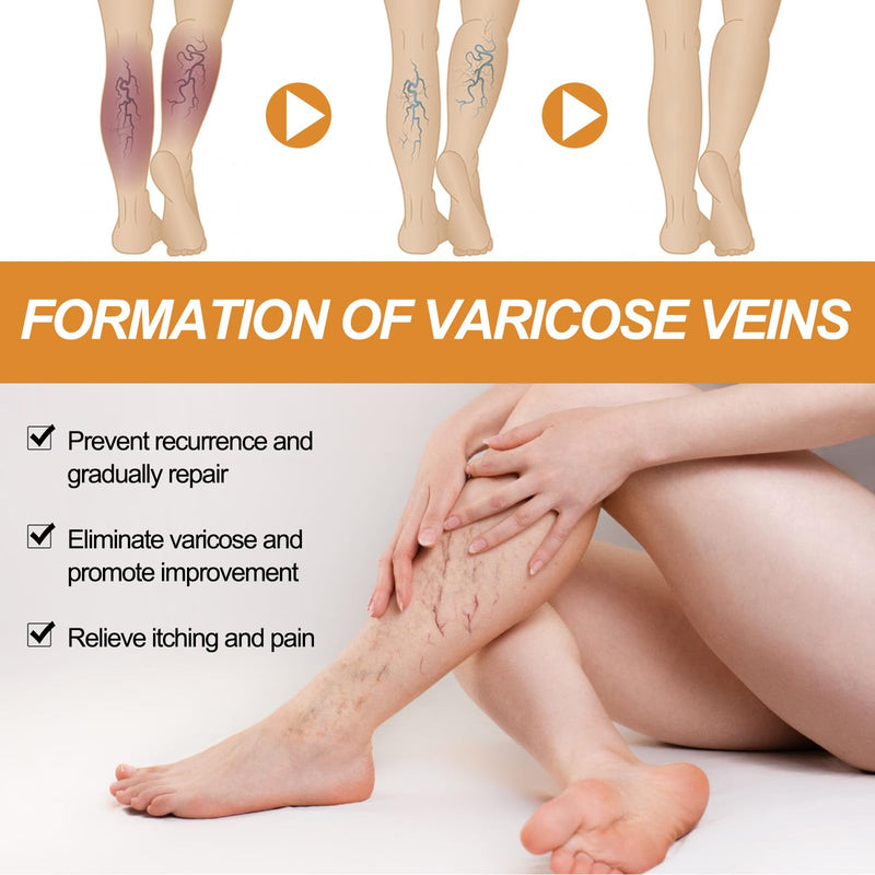 [Australia] - Grgowe varicose veins cream + vein repair spray, varicose veins cream, cream against spider veins, veins active, spider veins, relieves leg pain and swelling 