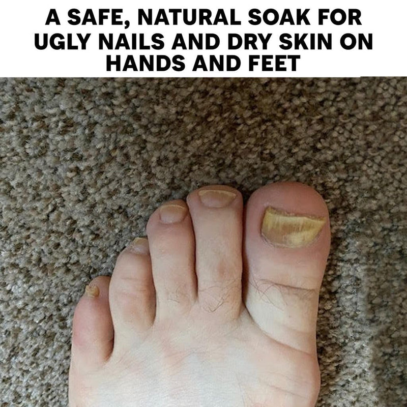 Long Creek Herbs Nail Soak 100 Percent Natural Hand and Foot Soak | Professional nail care, salon-quality results, home or studio, strengthens nails and softens skin, herbal nail soak 1 Count (Pack of 1)
