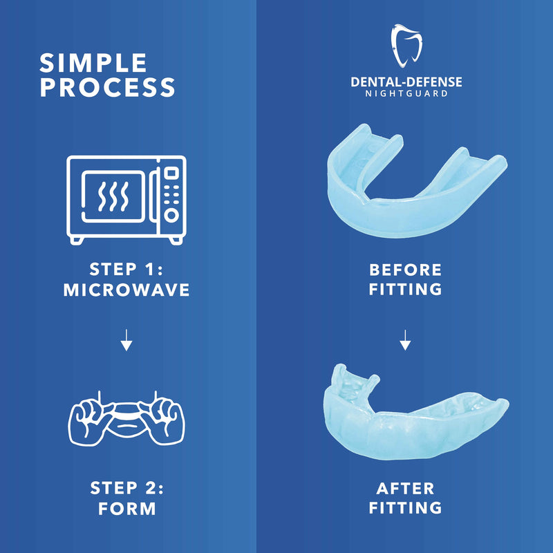 Professional Mouth Guard - 2 Pack Night Guard for Teeth Grinding & Clenching Relief, Protects Teeth at Night, Ideal for Comfort & Protection (Aqua) Aqua