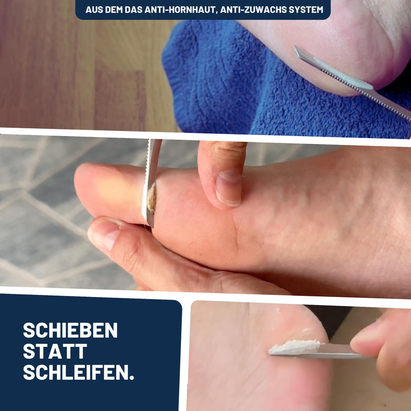 [Australia] - Mr. Fuss® No. 1 - Plus Pack Complete - Small, cuticle callus remover economy package 4 pieces. Active solution, quick & strong emollient - 200 ml, cotton wool, cutlery set 