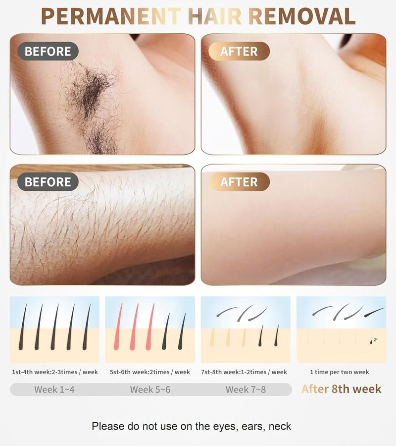 [Australia] - Laser Hair Removal Device IPL Hair Removal Permanent for Women at-Home, Painless Laser Hair Remover Whole Body Armpits Back Legs Arms Face Bikini Line White 