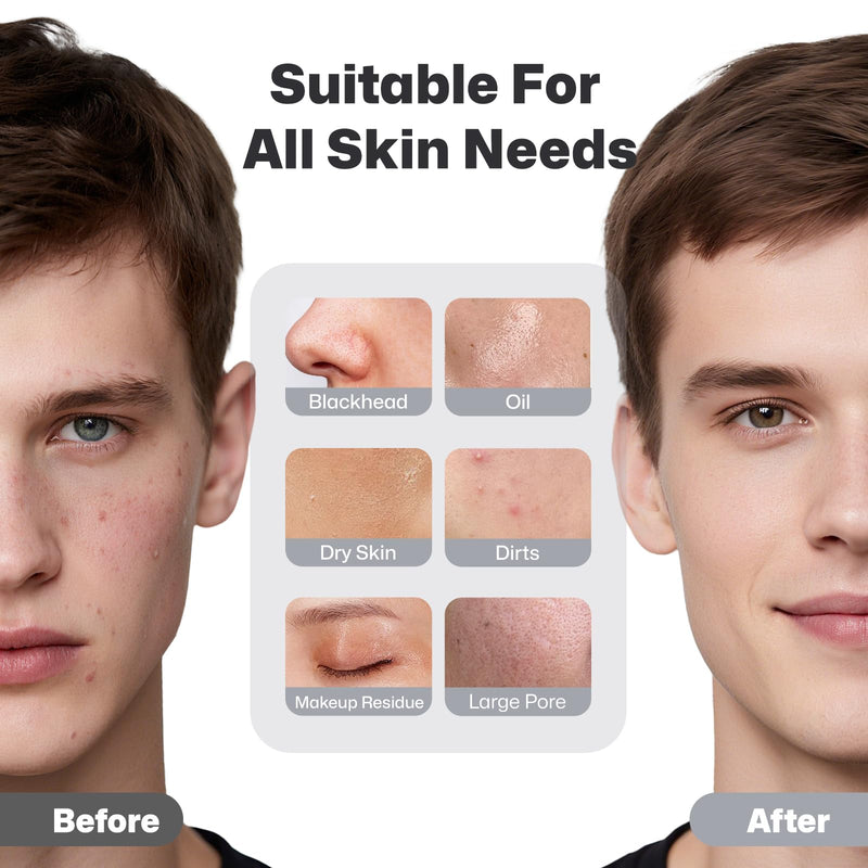 PRITECH Facial Cleansing Brush, Rechargeable Silicone Face Scrubber with Constant-Temperature Heating, Vibrating Exfoliator Scrubber for Deep Pore Cleaning, Waterproof Face Brush for Women & Men-Black Black