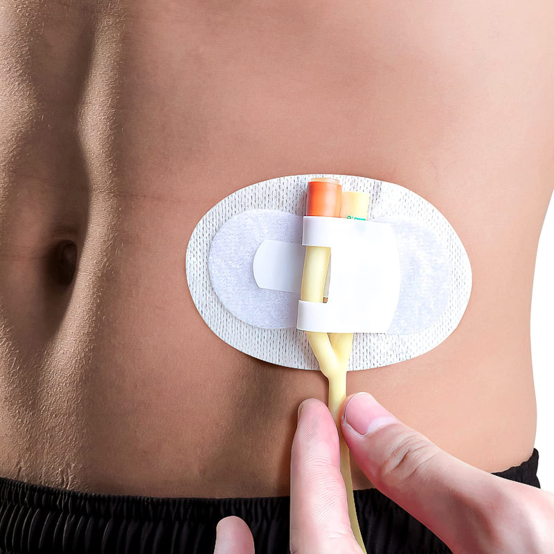 [Australia] - EXCEART 20Pcs Catheter Stabilization Device Legband Holder Sticker Catheter Tube Holder Perspiration Holes Legband Holder Urine Bag Holder Care 