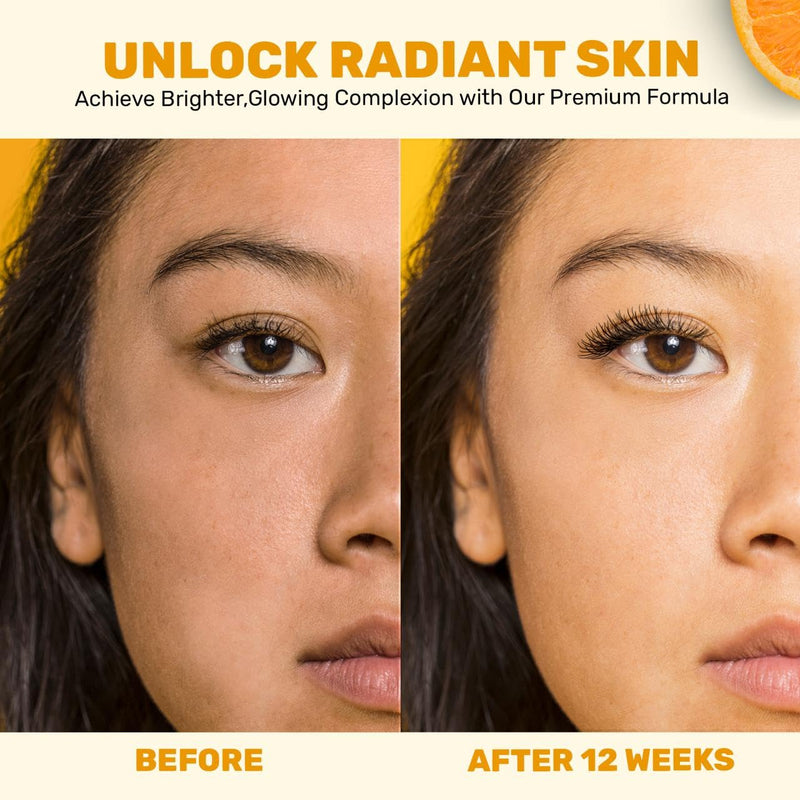 Gentle Vitamin C Serum – Brightening & Hydrating with Citrus Stem Cells and Chamomile, Safe for Rosacea & Sensitive Skin, 1oz