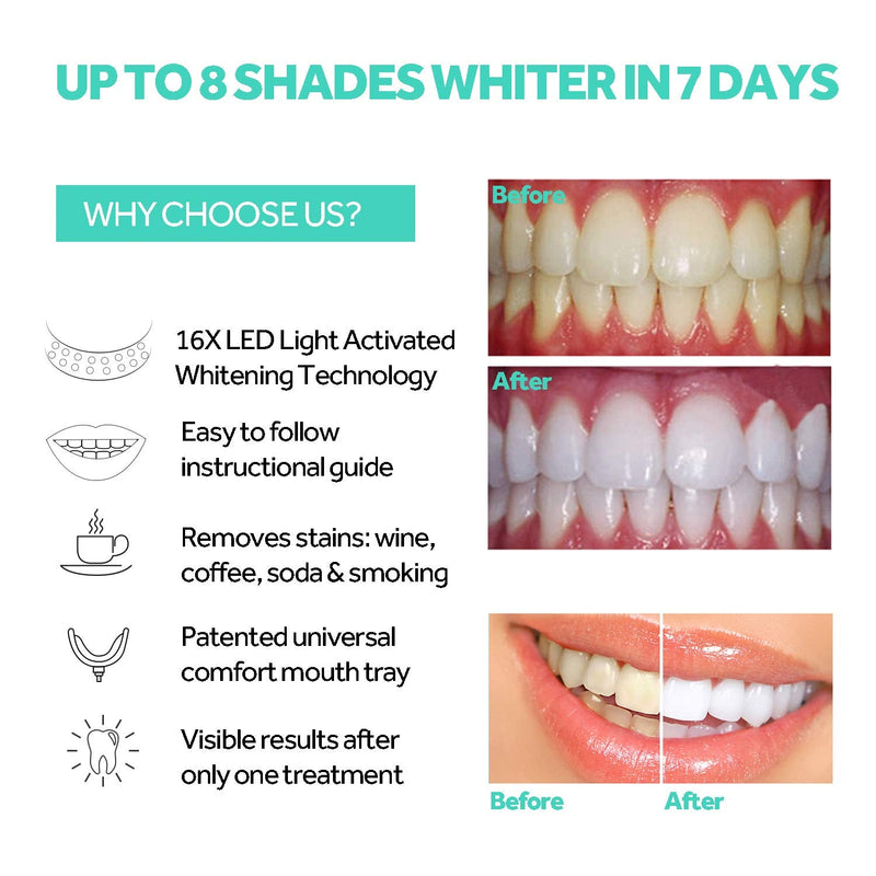 [Australia] - Teeth Whitening Accelerator Light, 16x More Powerful Blue LED Light, Mouth Tray Teeth Whitening Enhancer Light Trays Connected with iPhone/Micro-USB Android/USB for Home Use 