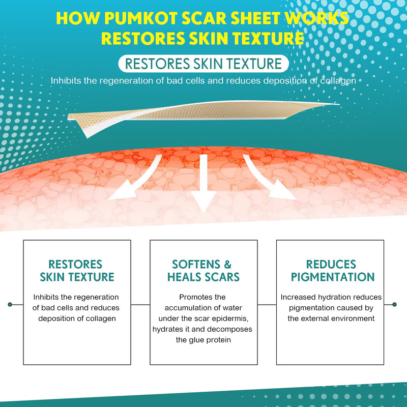 [Australia] - Silicone Scar Sheets, Silicone Scar Tape(1.6” x 120” Roll-3M), Scar Removal Away Strips for Surgical Scars, Keloid, C-Section, Burn et 120x1.6 Inch (Pack of 1) 